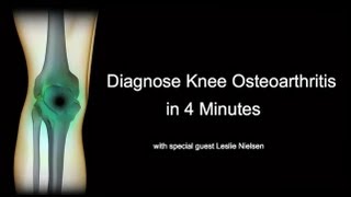 Diagnose Knee Osteoarthritis in 4 Minutes with Leslie Nielsen [upl. by Saval]