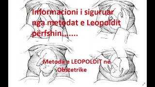 Metoda e LEOPOLDIT ne Obstetrike  Leopolds maneuvers [upl. by Aihsenrad]