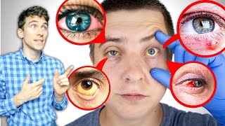 9 Ways Your EYES Tell You About Your Health [upl. by Nylinnej]