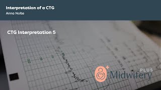 Interpretation of a CTG [upl. by Pressman]