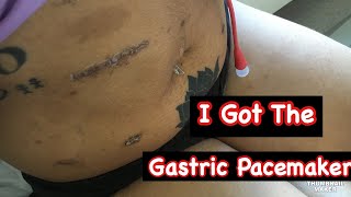 I Got The Gastric Pacemaker Gastricpacemaker jtube gastroparesis [upl. by Templas]