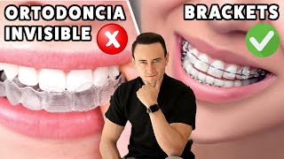 La ortodoncia invisible NO ES PARA TODOS  Brackets vs Invisalign [upl. by Ail591]