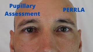 Pupillary Assessment PERRLA [upl. by Archle]