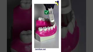 Effective Tooth Brushing Techniquesorthodontics dentist orthodontistbrushing toothpaste brush [upl. by Aicelef374]