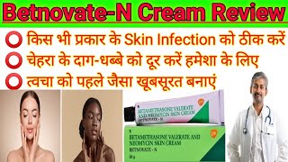 BetnovateN। BetnovateN Skin cream review 2023। How to uses betnovate n skin cream on face। [upl. by Dorella43]