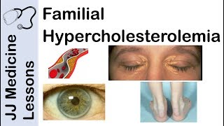 Familial Hypercholesterolemia  Genetics Pathophysiology Symptoms and Treatment [upl. by Arrahs]