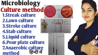 Culture method in hindi  Culture method in microbiology  Types of culture method microbiology [upl. by Ettennaj466]