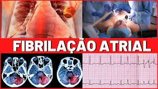 FIBRILAÇÃO ATRIAL  O QUE É  CAUSAS  TRATAMENTO  É GRAVE  TUDO QUE VOCÊ PRECISA SABER [upl. by Esmerolda]