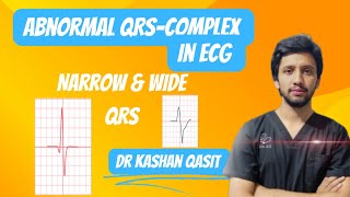 Abnormal QRS Complex In ECG QRS ComplexNarrow amp Wide QRS ECGEKGDr Kashan Qasit [upl. by Nnylyam]