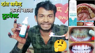 Ye kya lagaa liya yaar teeth WHITENING foam Shocking Result [upl. by Anerdna]