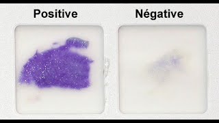 Oxidase Test Practical Tutorial [upl. by Nirro]