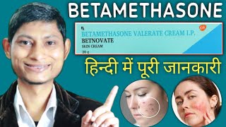 betamethasone valerate cream ip  betamethasone dipropionate cream  betnovate cream ke fayde [upl. by Owain]