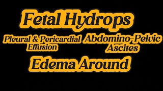 Fetal Hydrops  Ascites  Swelling  Pleural amp Pericardial Effusion  IUD 25 weeks on Ultrasound [upl. by Alecia698]