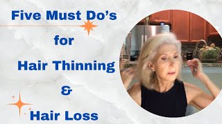 Five Must Do’s for Thinning amp Hair Loss [upl. by Phyl983]