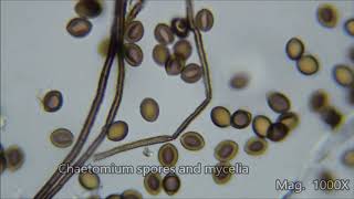 Toxic House Mold Under the Microscope [upl. by Navanod]