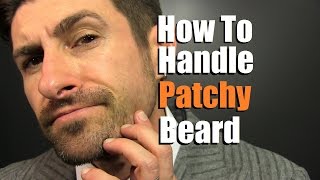 How To Deal With A Patchy Beard  Bald Spot Reduction Tips [upl. by Amanda]