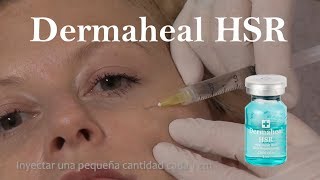 Dermaheal HSR producto de mesoterapia para rejuvenecimiento estrías y cicatrices de acné [upl. by Iat]