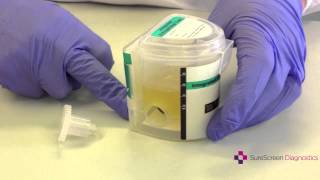 How To Drug Test Using a SureScreen Integrated Cup [upl. by Sikorski266]