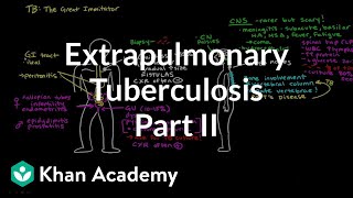 Extrapulmonary TB Part 2  Infectious diseases  NCLEXRN  Khan Academy [upl. by Downey801]