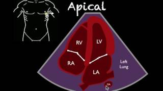 Bedside Ultrasound Basic Cardiac US [upl. by Devaney]