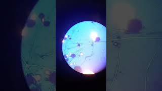 Rhizopus under microscope microbiology science [upl. by Hsuk189]