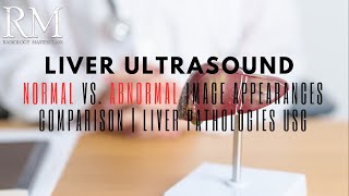 Liver Ultrasound Normal vs Abnormal Image Appearances Comparison  Liver Pathologies USG [upl. by Collayer]