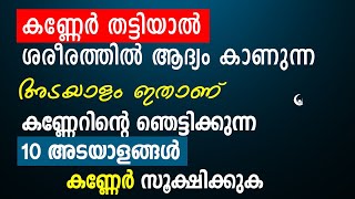 കണ്ണേർ തട്ടിയാൽ ആദ്യം കാണുന്ന അടയാളങ്ങൾ ഇതാണ്  കണ്ണേർ സൂക്ഷിക്കുക  Islamic Dua [upl. by Eskill849]