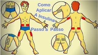 como aplicar a insulina passo a passo [upl. by Annoik855]