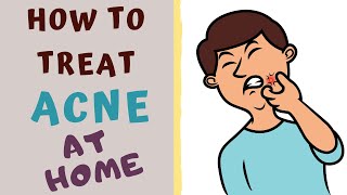 HOW TO TREAT ACNE AT HOME Acne All you need to know [upl. by Augy]