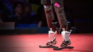 New bionics let us run climb and dance  Hugh Herr  TED [upl. by Johnette]