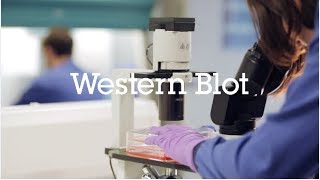 Western blot protocol video [upl. by Repsaj]