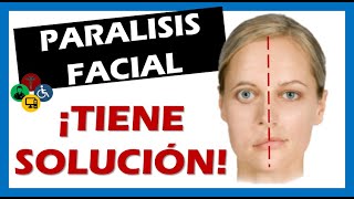 PARALISIS FACIAL causas y tratamiento  Parálisis facial central y periférica [upl. by Aneetsyrk]