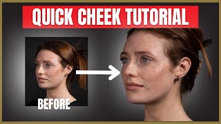 Quick Cheek Filler Tutorial  Cheek Dermal Filler Injection Advice [upl. by Domonic]