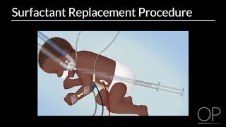 Surfactant Replacement in Neonates by B Walsh  OPENPediatrics [upl. by Warenne]