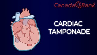 Cardiac Tamponade [upl. by Seagraves]