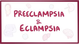 Preeclampsia amp eclampsia  causes symptoms diagnosis treatment pathology [upl. by Yanahc]