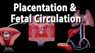 Patent Ductus Arteriosus [upl. by Marietta]