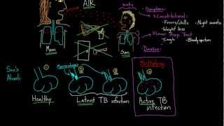 Symptoms and Spread of Tuberculosis [upl. by Sirron928]