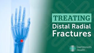 Treating Distal Radius Fractures at Dartmouth Health [upl. by Nailil]