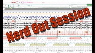 Polysomnography Nerd Out Severe OSA Fixed REM Rebound PAP Titration Progression Delta Raw Data [upl. by Cacie893]