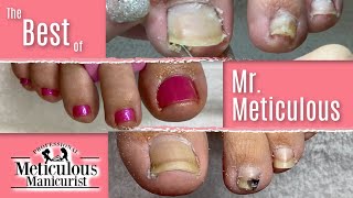 The Best of Mr Meticulous Pedicures ASMR [upl. by Ardnalahs]