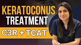 Keratoconus Treatment C3R TCAT C3R [upl. by Aner]