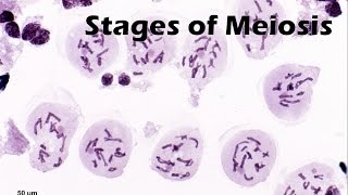 Stages of Meiosis [upl. by Ydualc]