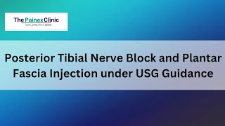 Posterior Tibial Nerve Block and Plantar Fascia Injection under USG Guidance [upl. by Essirehs]