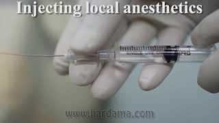 Spinal anesthesia [upl. by Aleekat915]