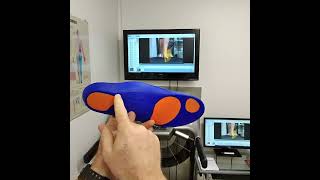 Heel Pain Treatment With Soft Orthotic Insoles [upl. by Assilanna]