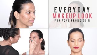 How To Makeup Look For Problematic amp Acne Prone Skin  Everyday Makeup Tutorial For Beginners [upl. by Mainis]