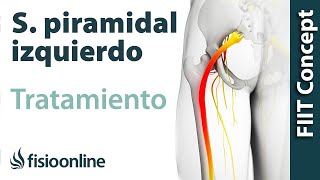 Tratamiento del síndrome piramidal izquierdo [upl. by Aruol]