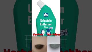 Urinstein entfernen das hilft wirklich Härtefall mit Salzsäure Dr Becher Urinstein Entferner WC [upl. by Tiram91]