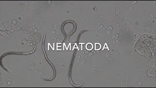 Nematodes [upl. by Ennaer]